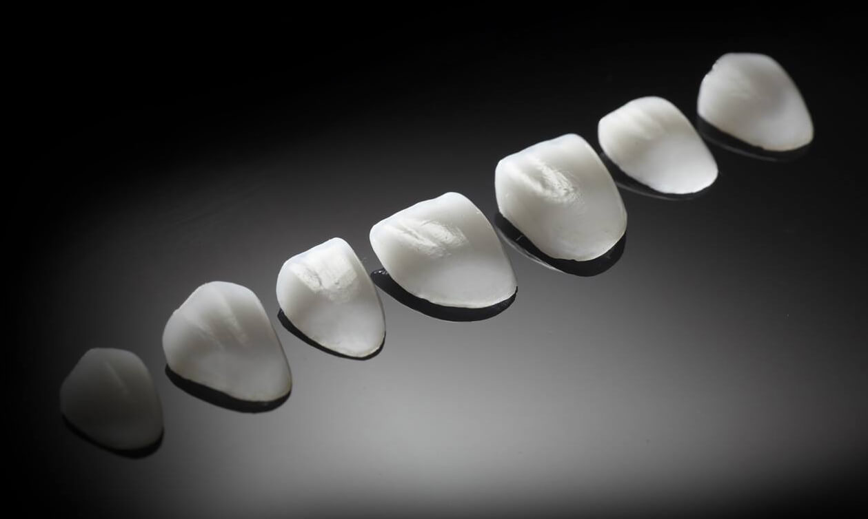 Sonrisa luminosa tras un tratamiento estético