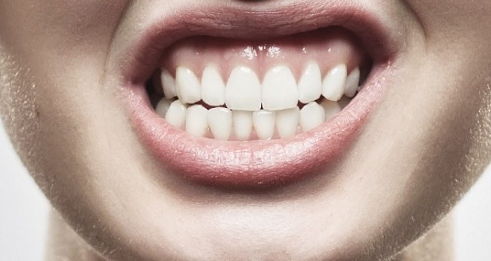 Sensibilidad dental en P&P Clinic Madrid