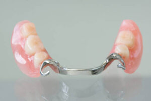 prótesis dental 