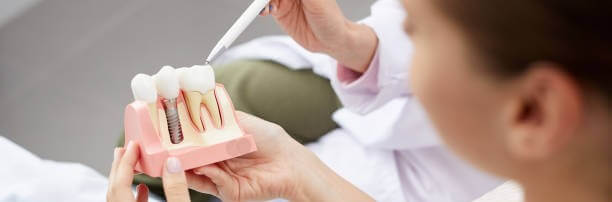 ventajas y desventajas del implante dental