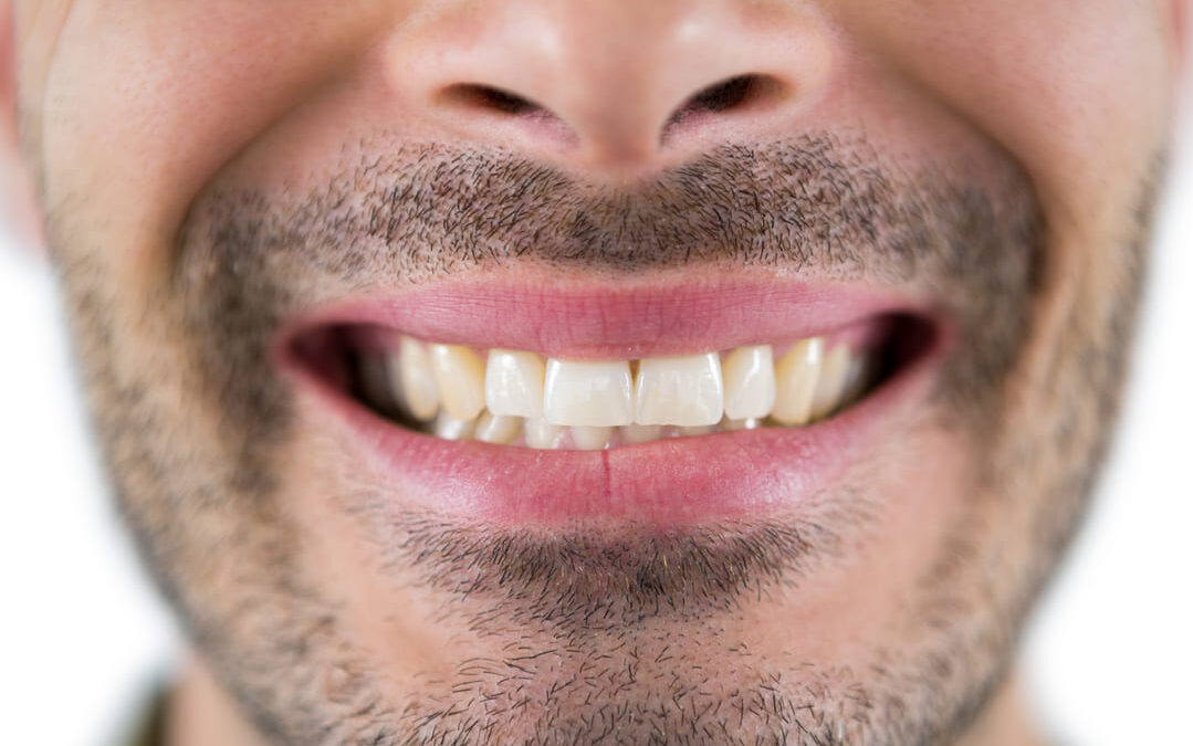 Manchas de tabaco en los dientes