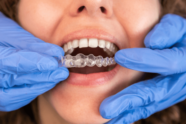 Corregir la posición de los dientes con ortodoncia