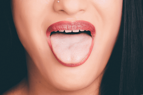 Trismus dental: ¿Te cuesta abrir la boca?