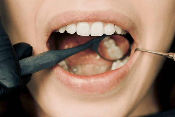 ¿Qué es un estudio de ortodoncia?