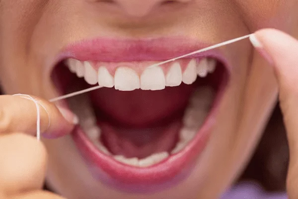 Épulis dental, cómo se trata y de qué forma se puede evitar