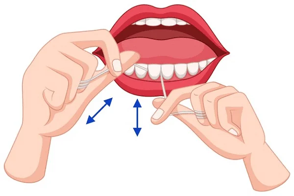 Protusión dental qué es Cómo se trata