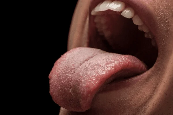 enfermedades de la lengua más comunes causas y soluciones
