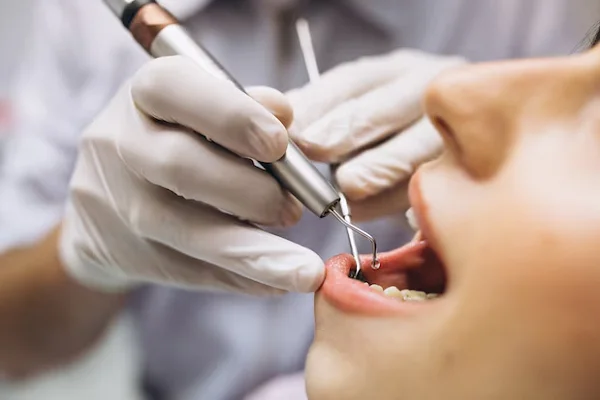 Endodoncia o extracción dental