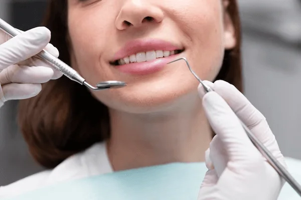 Instrucciones para el blanqueamiento dental
