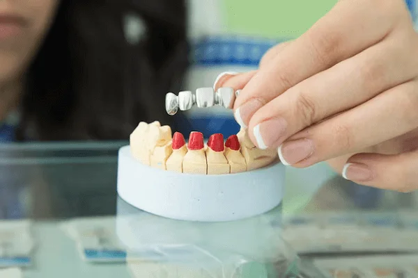 Proceso para implantes y prótesis dentales