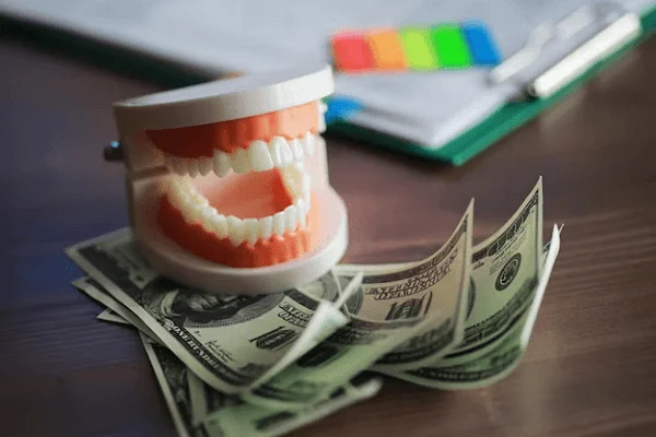 Todo sobre el Empaste Dental: Tiempos y costes
