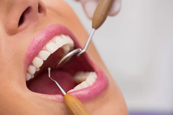 Tratamientos de ortodoncia con extracción