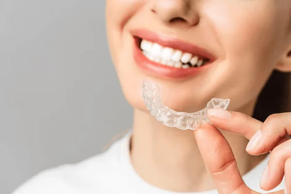 Retenedores dentales