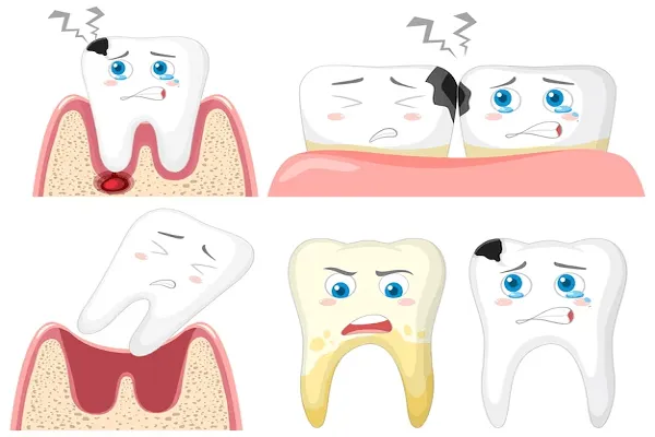 ¿Cómo tratar un diente dañado por dentro?