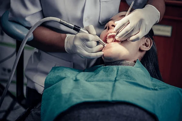 Importancia de la cirugía periodental a tiempo