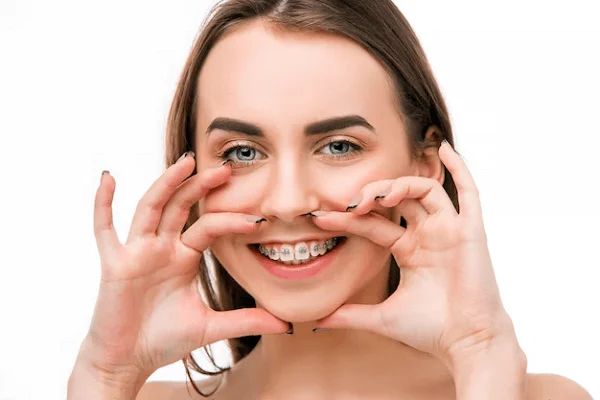 Mala alineación dental
