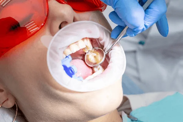 Reconstrucción dental
