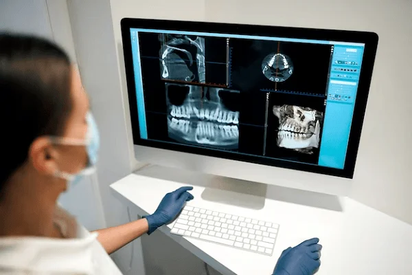 Todo sobre el TAC dental: una visión completa