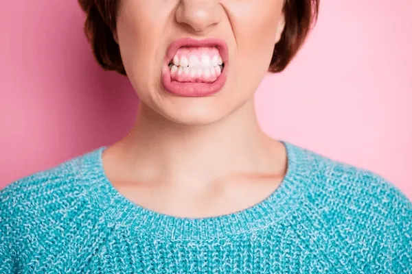 Qué es la sonrisa gingival y cómo tratarlo