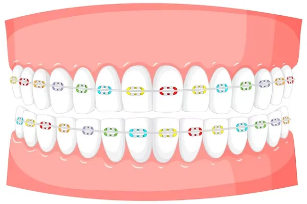 Conoce los Nombres de tus Dientes y su Importancia