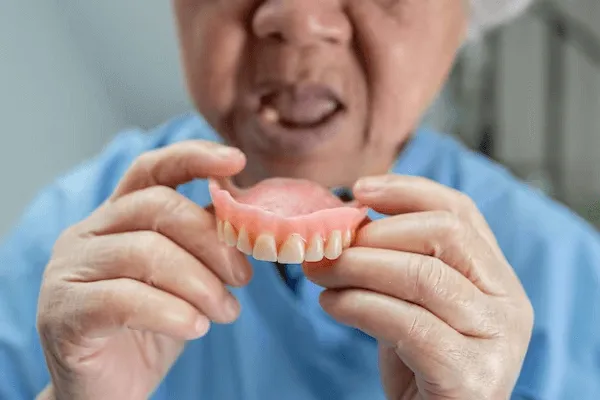 Precios de Implantes Dentales para toda la Boca