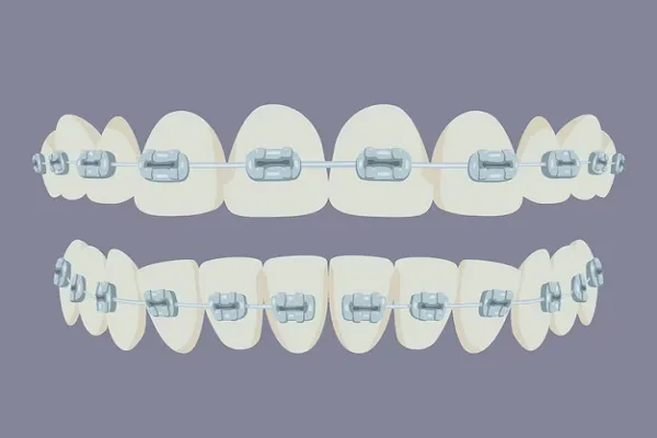 Conoce los Nombres de tus Dientes y su Importancia