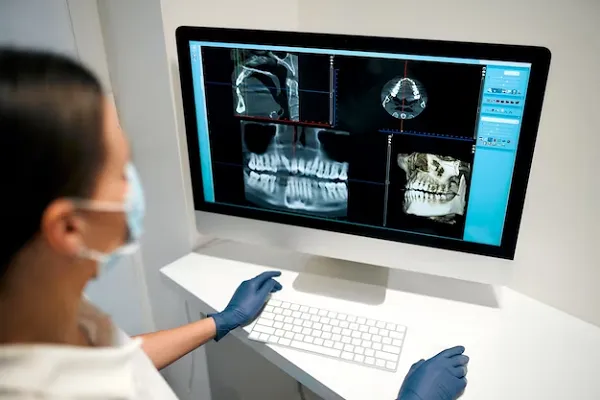 Precio de Radiografía Dental en Vitaldent
