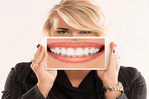 Precios de Carillas Dentales y Estética Dental en España