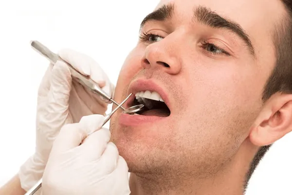 Descubre la importancia del disyuntor de paladar en la ortodoncia