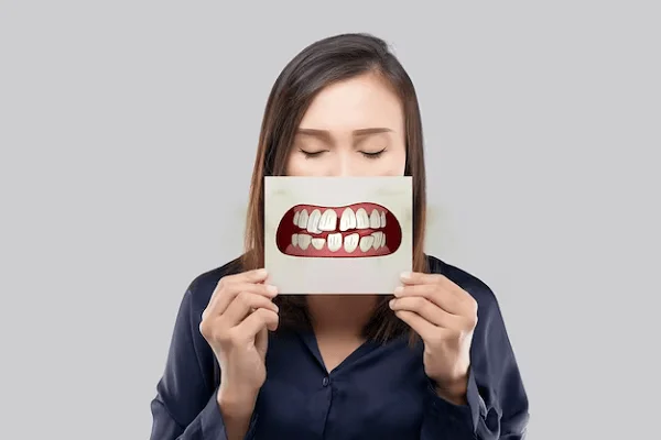 Placa dental como un problema común