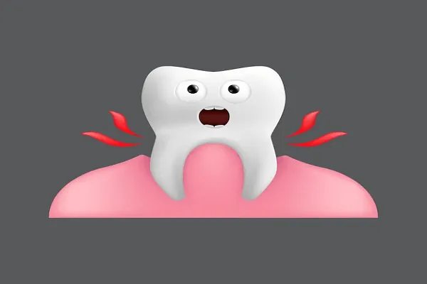 Caída de un diente por periodontitis: ¿Qué hacer?