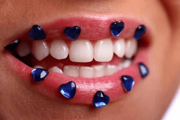Gemas dentales: ¿Es seguro sumarse a esta tendencia?