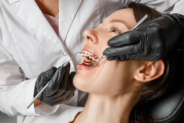 Corrección de Dientes Separados con Brackets