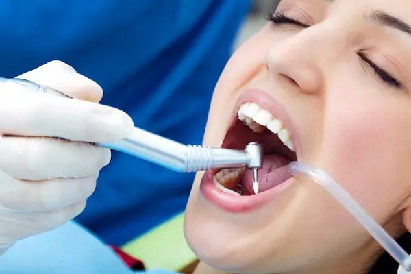 Limpieza Dental: Precios y Métodos