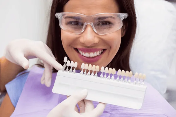 Los mejores tratamientos dentales con carillas