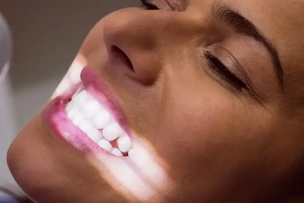 Mitos sobre el blanqueamiento dental