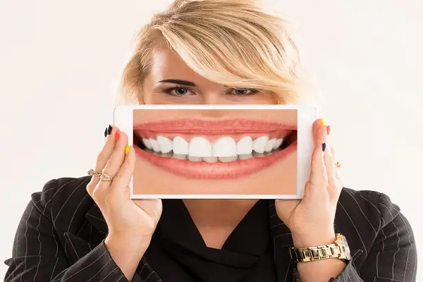 Aparición de la placa dental