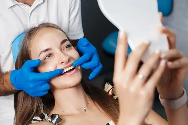 Colocación de las carillas dentales