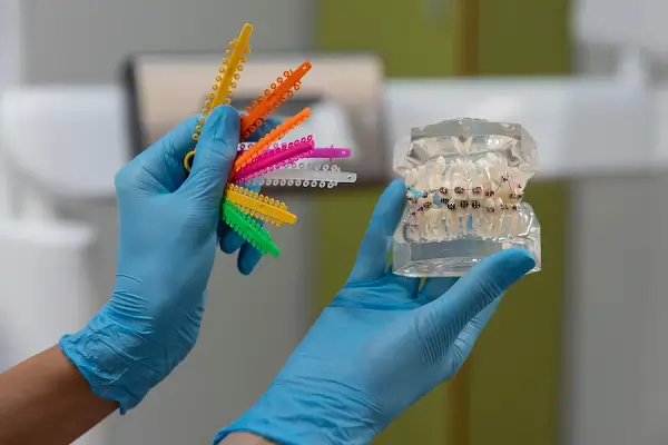 Proceso de colocación de los brackets