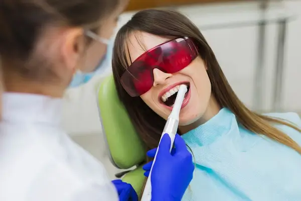 Blanqueamiento dental con peróxido de hidrógeno