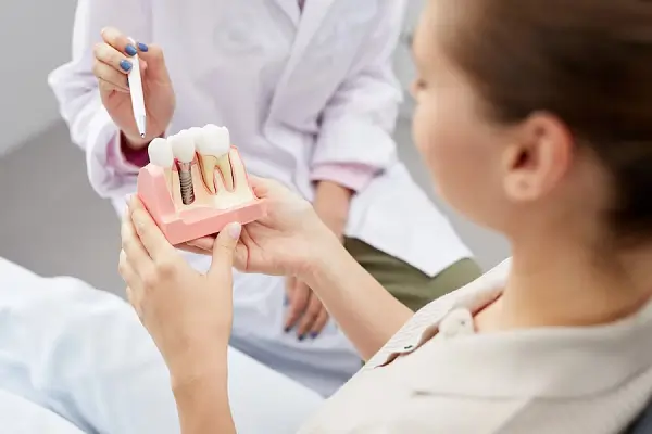 Efectividad de los implantes dentales