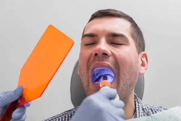 Eliminación de placa bacteriana y sarro