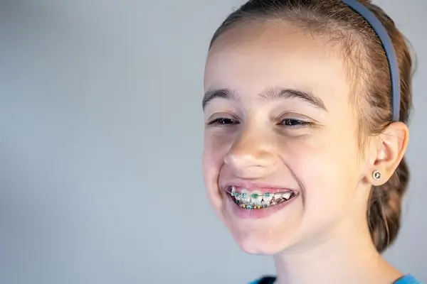 Guía Completa sobre la Ortodoncia Infantil