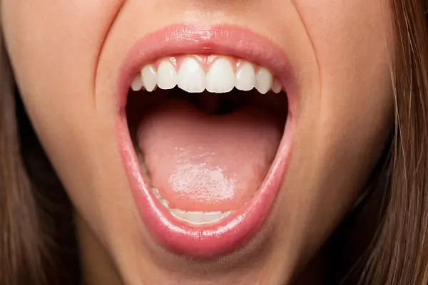 Qué son las manchas en la lengua y cómo tratarlas
