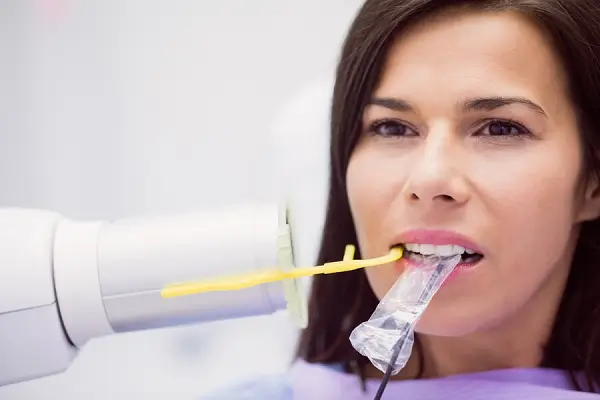 Todo sobre el escalador dental su uso y beneficios