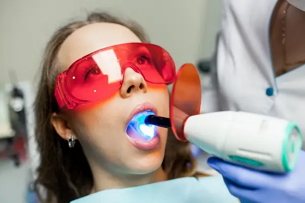 Tratamientos efectivos para dientes blancos