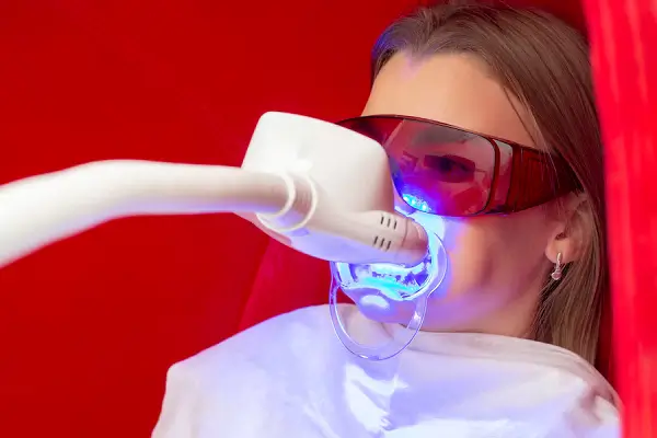 Descubre el blanqueamiento dental con Philips Zoom