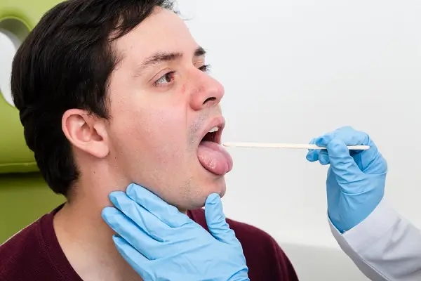 ¿El Coronavirus puede causar hinchazón en los labios?