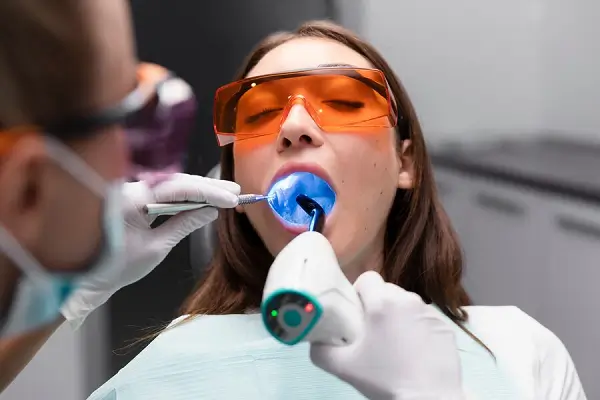Guía profesional para el blanqueamiento dental