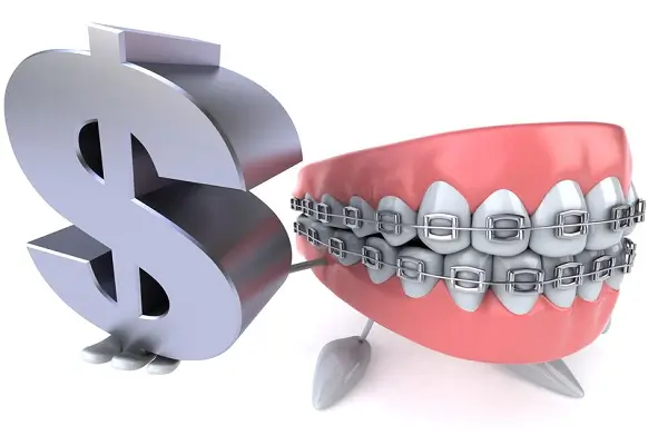 Información sobre brackets metálicos Tipos y precios